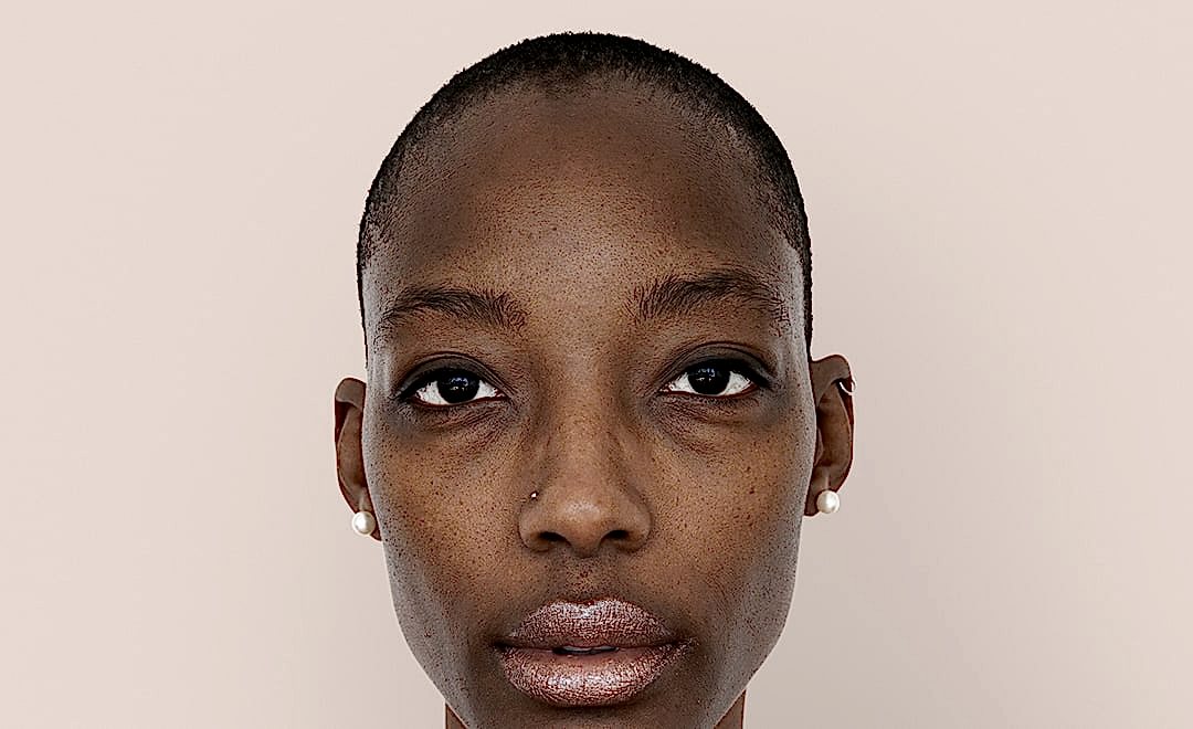 Under Eye Filling (Light Filling)